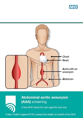 Abdominal aortic aneurysm (AAA) screening (leaflet)