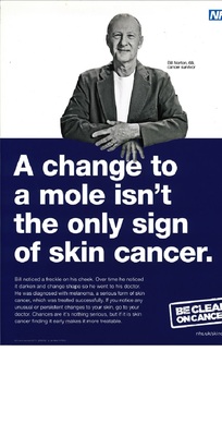 A change to a mole isn't the only sign of skin cancer (A3 poster)