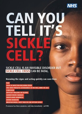 Can you tell it's sickle cell? - female (A3 poster)