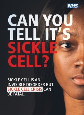 Can you tell it's sickle cell? - female (A5 flyer)